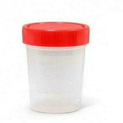 ENVASE RECOGIDA ORINA ACOFAR 100 ML